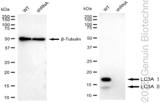 WB - KD-Validated Anti-MAP1LC3A Rabbit Monoclonal Antibody AGI1011